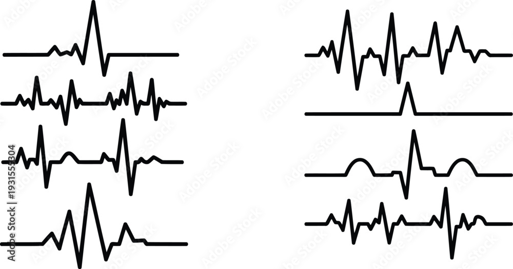 Fototapeta premium Multiple electrocardiogram readings on a white background