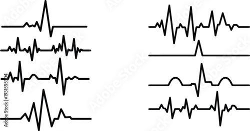 Multiple electrocardiogram readings on a white background