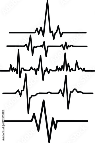 Multiple electrocardiogram tracings on a white background