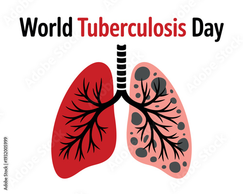 An illustration of lungs for World Tuberculosis Day, highlighting the impact of TB on respiratory health.