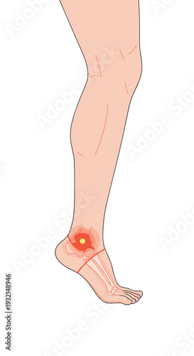 A human leg and foot are illustrated in profile, showing a red highlighted area of pain on the ankle joint.