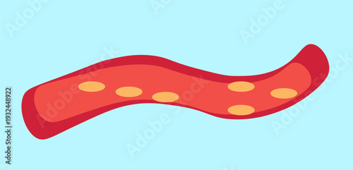 blood vessels with cholesterol on a light blue background,