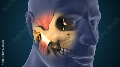 Foto Medical Illustration of Temporomandibular Joint Disorder