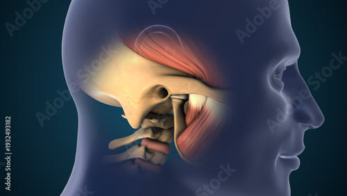 Medical Illustration of Temporomandibular Joint Disorder