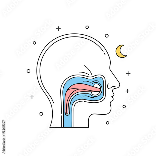 Flat Vector Illustration of Sleep Apnea Airway Blockage