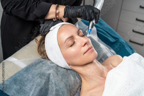 Woman getting microneedling procedure for skin rejuvenation on her face