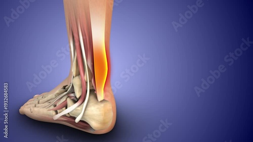 Achilles Tendon Pain and Ankle Anatomy 3D Animation