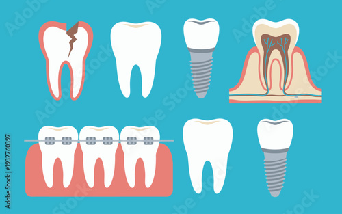 Dental care concepts showing cracked tooth braces implant and cross section blue background