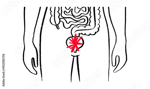 Bladder inflammation pain
