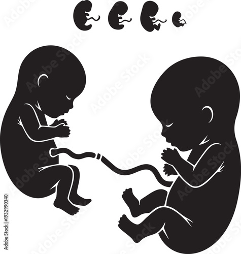 Twin fetuses development stages in womb with umbilical cords connected showing prenatal growth process and embryonic evolution