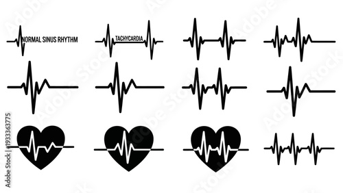 Medical Heartbeat ECG Vector Icons Normal Sinus Rhythm and Tachycardia EPS10 Stock.eps