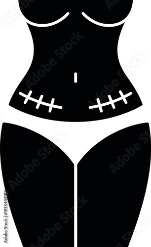 A black silhouette of a woman's torso with white underwear and stitches on her waist, symbolizing tummy tuck surgery