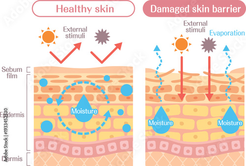 Skin barrier function diagram healthy vs damaged