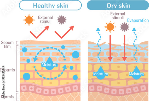 Dry skin structure diagram comparison