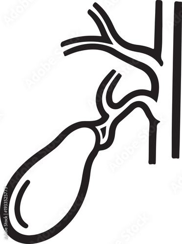 Stylized black and white line art illustration of gallbladder and bile ducts on a grey checkered background