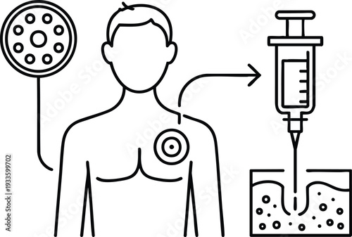 Illustrated Guide to Subcutaneous Injection or Biopsy, Targeted Medical Procedure and Syringe Application Diagram, vector, illustration, silhouette.