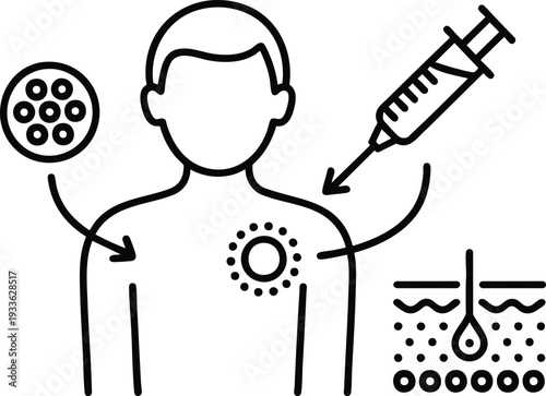 Technical Medical Illustration of a Tissue Sampling Procedure, Dermatological Treatment and Localized Injection Graphic, vector, illustration, silhouette.