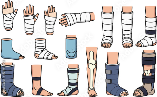 Medical cast and bandage set with hand wrist leg foot brace support orthopedic injury treatment vector illustration isolated on white