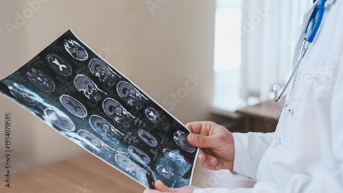 A doctor examines a close-up of a brain MRI in a hospital office. Diagnosis of neurological problems and migraines, stroke, concussion, and head injury.