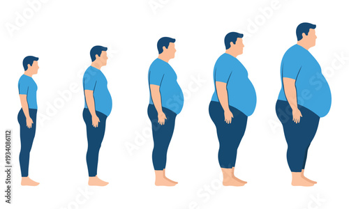 Male body fat progression stages, from lean to severely obese