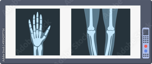 Medical X rays showing human hand and leg bones
