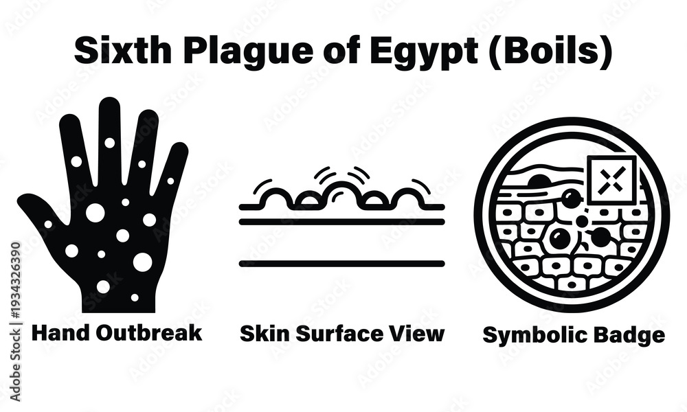 Obraz premium Biblical sixth plague of Egypt boils skin outbreak