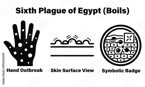 Biblical sixth plague of Egypt boils skin outbreak