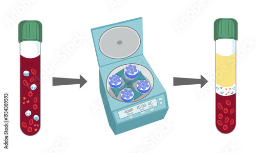 Blood Plasma Separation Process- Centrifugation of Blood Sample in Heparin Tube