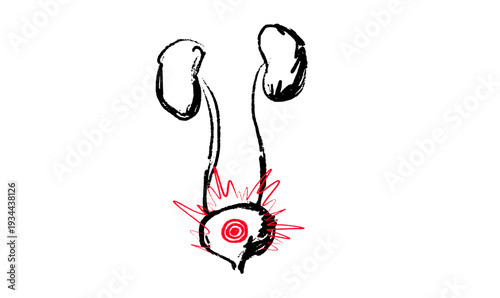 Bladder inflammation pain