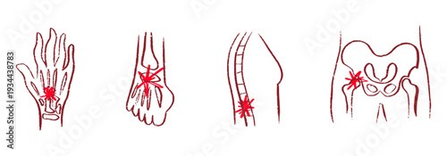 Arthritis Sketch Poster