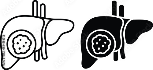 Liver with Tumor in Simple Line Art Style with Black and White Color on White Background for Medical Illustration