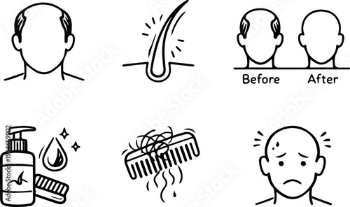 Hair loss baldness treatment care icons. Vector