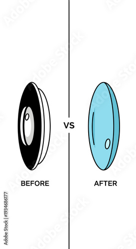 Contact Lens Transformation: A Visual Comparison of Before and After for Eye Health and Vision