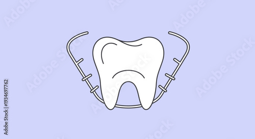 Dental Illustration Of A Single Tooth And Retainer With A Light Purple Background