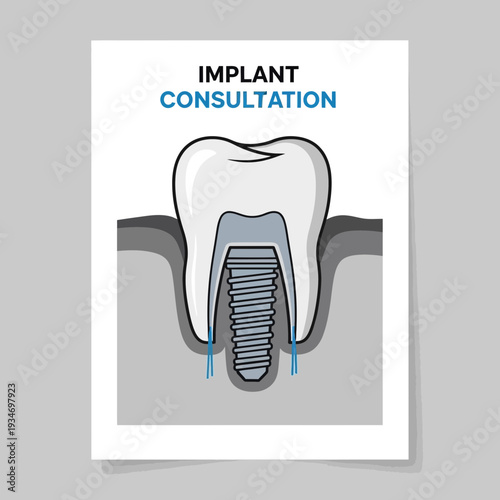 Dental Implant Consultation: A Comprehensive Guide to Restoring Oral Health and Function