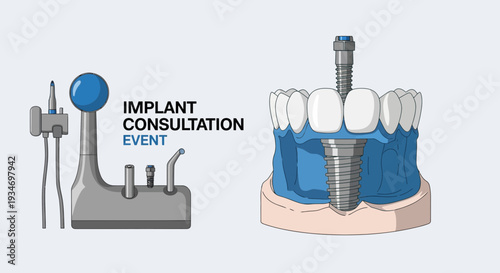 Dental Implant Consultation Event Promotion for Modern and Innovative Treatments