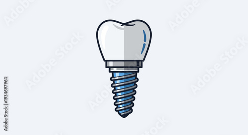 Dental Implant Illustration: A Detailed Graphic Representation of Tooth Replacement