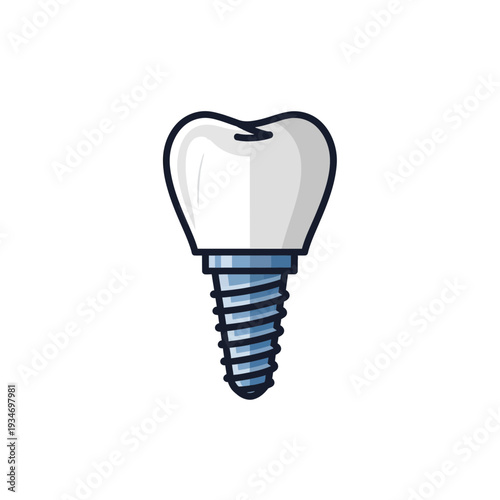Dental Implant Illustration: Anatomical Representation of a Healthy, Restored Molar with Surgical
