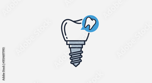 Dental Implant Illustration Demonstrating Artificial Tooth Replacement and Oral Health Treatment