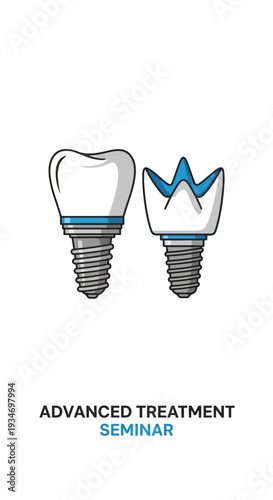 Dental Implant Illustration Demonstrating Advanced Treatment Seminar Concepts With Precision