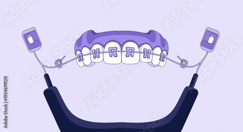Dental Orthodontic Treatment Illustration Showing Teeth With Braces Attached And Related Accessories
