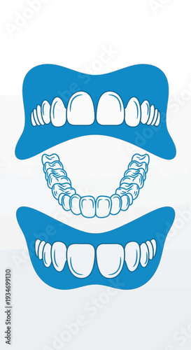 Dental Orthodontic Treatment Illustration Showing Clear Aligners for Teeth Alignment and Improvement
