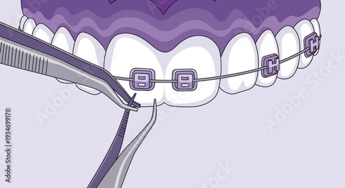Dental Orthodontics Illustration Depicting Teeth, Braces, and Tools for Treatment and Care