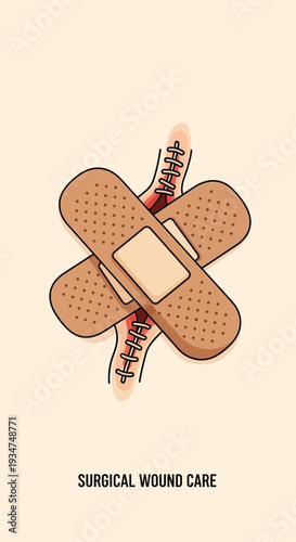Illustrated Representation Of A Surgical Wound With Bandages Depicting Medical Healthcare and