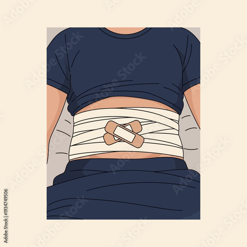 Illustration Depicting Abdominal Injury and Bandaged Torso Representing Medical Care