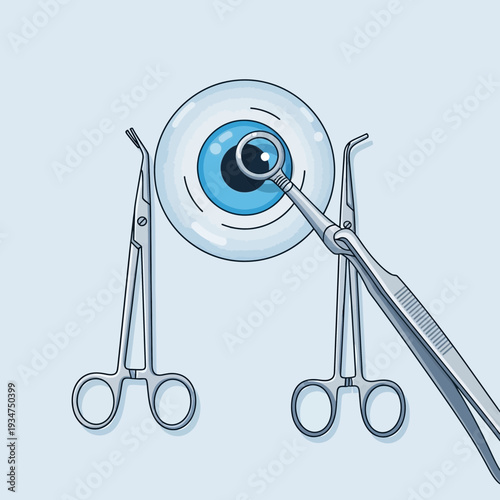 Illustration Depicting Eye Surgery with Surgical Instruments on a Light Blue Background