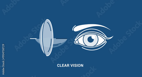 Illustration Of Vision Correction With Contact Lens And Eye With Clear Vision Text