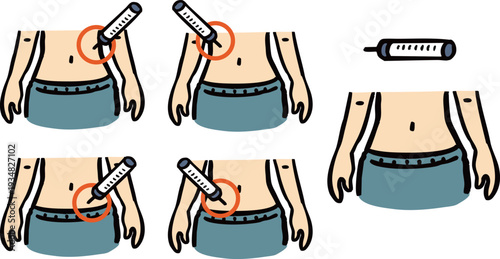 お腹への注射　注射位置　イラストセット
