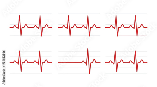 Electrocardiogram ECG waveforms vector set with heartbeat, medical, healthcare, diagnostics, cardiology, hospital, patient monitoring, emergency, wellness, treatment, pulse, cardiac rhythm, vector des