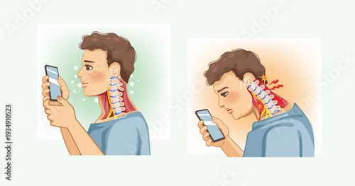 Text Neck Syndrome Cervical Spine Comparison